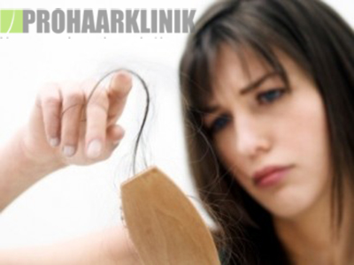 Haartransplantation vorher nachher Bilder